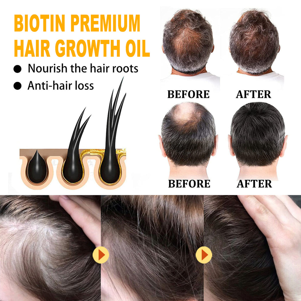 Biotin Hair Treatment Oil, Deeply Moisturizes Scalp for Massage Treatments
