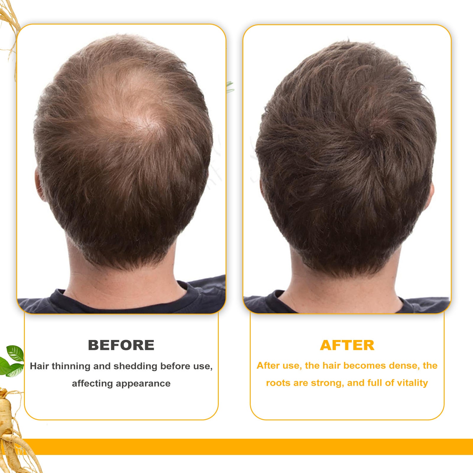 Biotin Hair Treatment Oil, Deeply Moisturizes Scalp for Massage Treatments