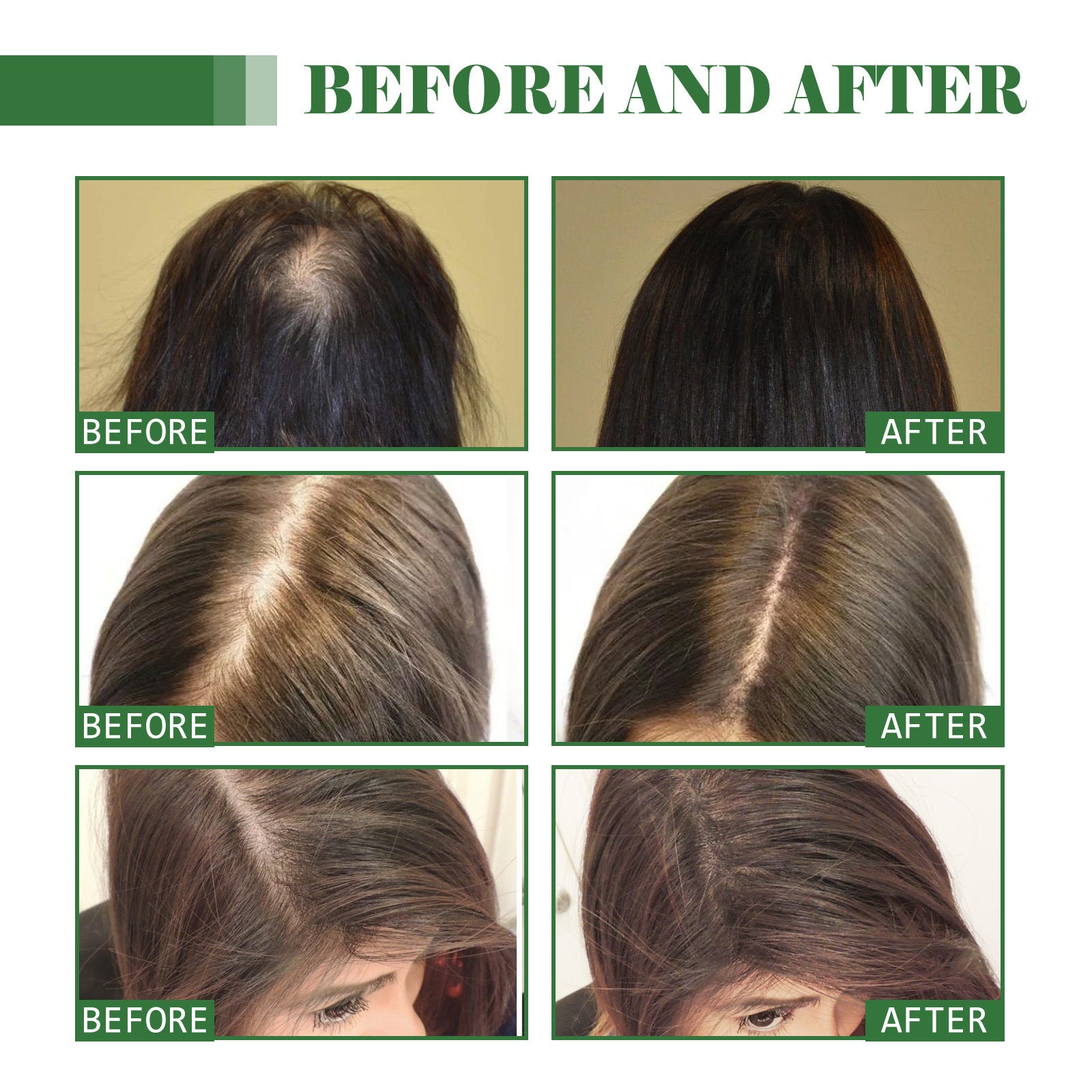 Hair Softening Oil Moisturizer| Dry Hair Repair